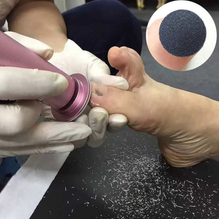 Electric Foot File – Rechargeable Callus & Dead Skin Remover