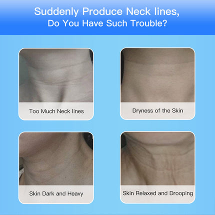 EMS Face & Neck Device – LED Therapy for Lifting & Tightening